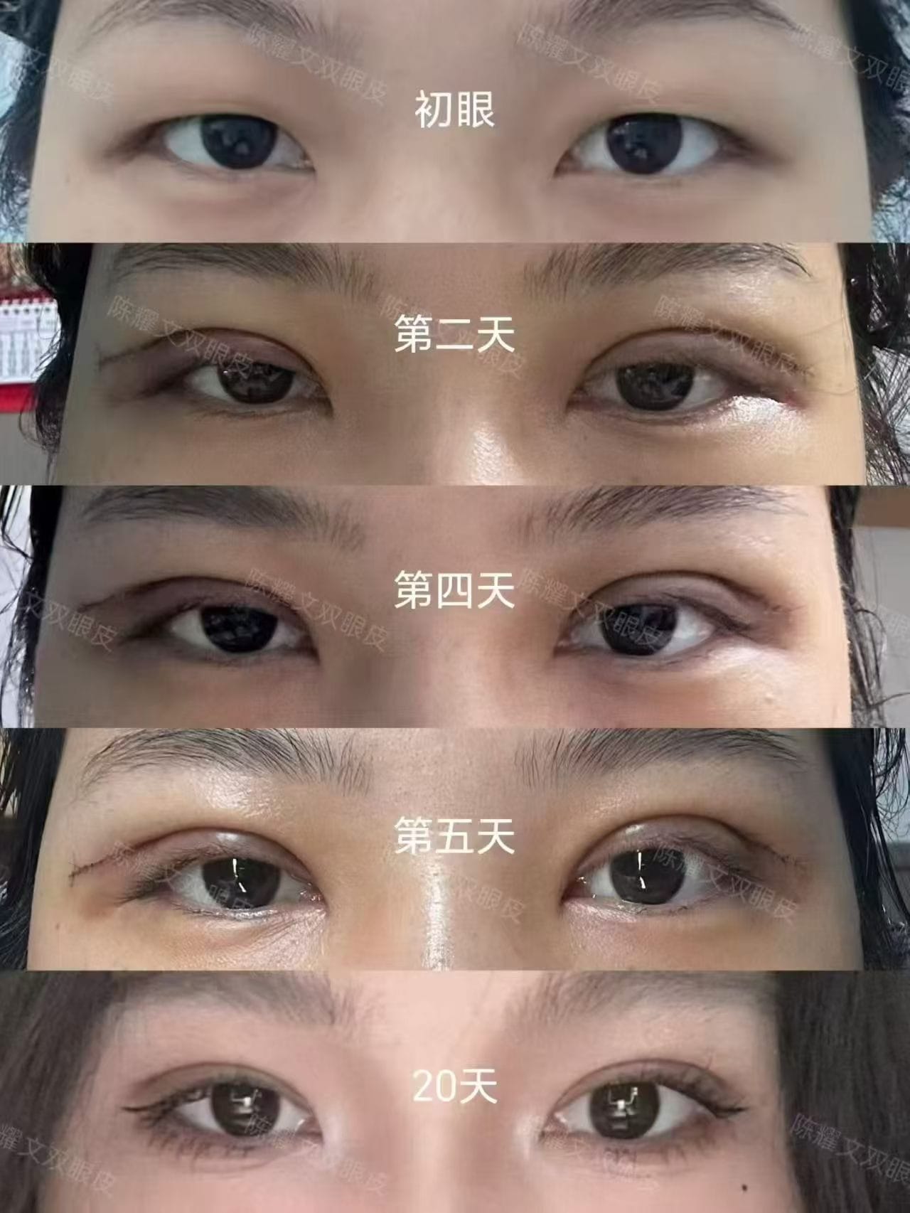 案例2