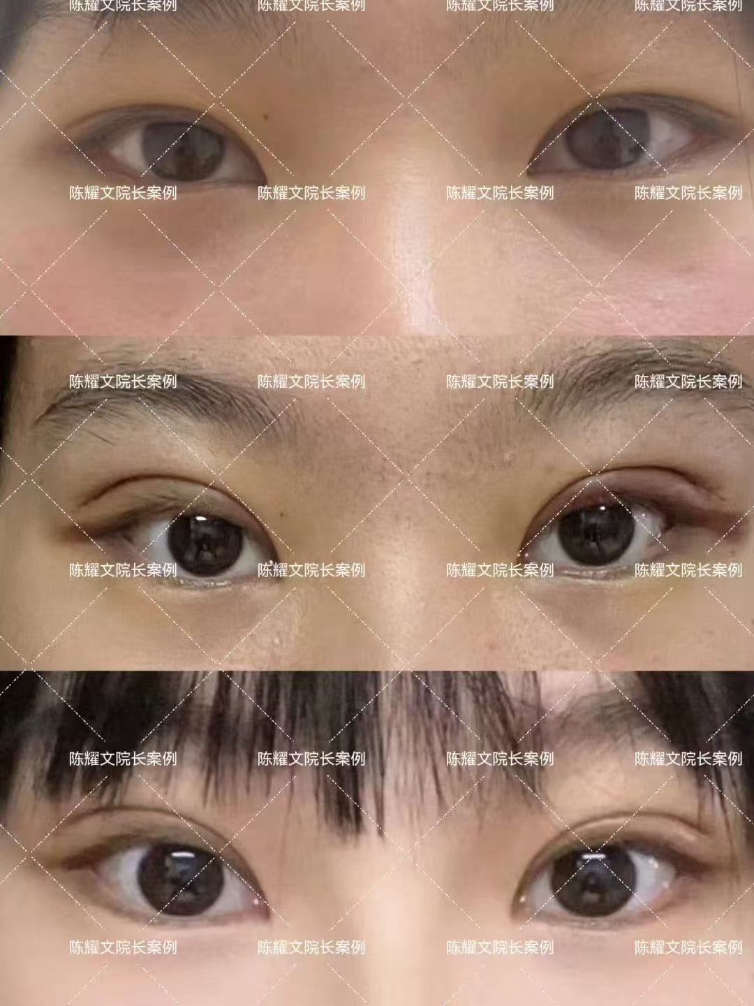 案例4
