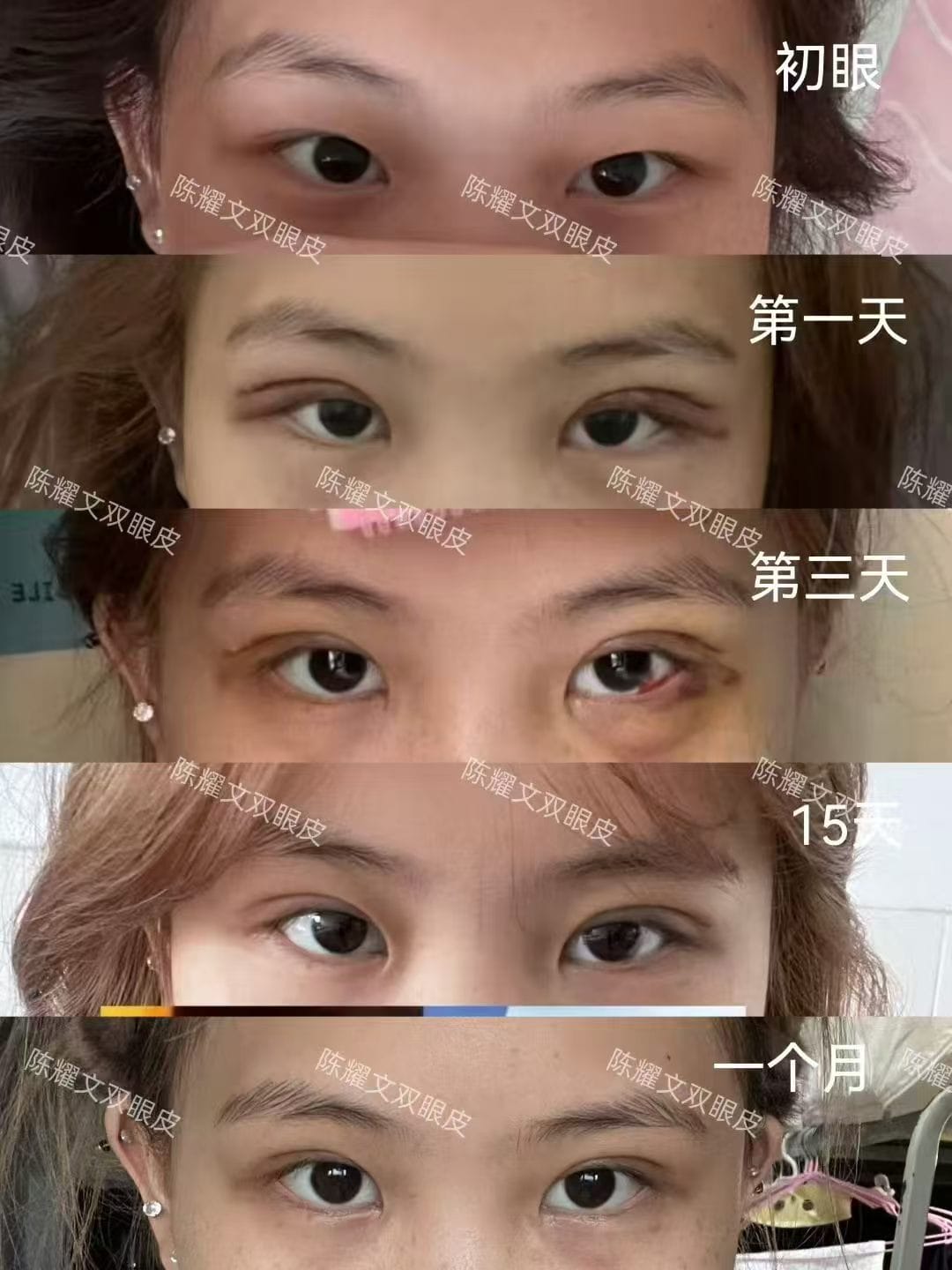 案例5