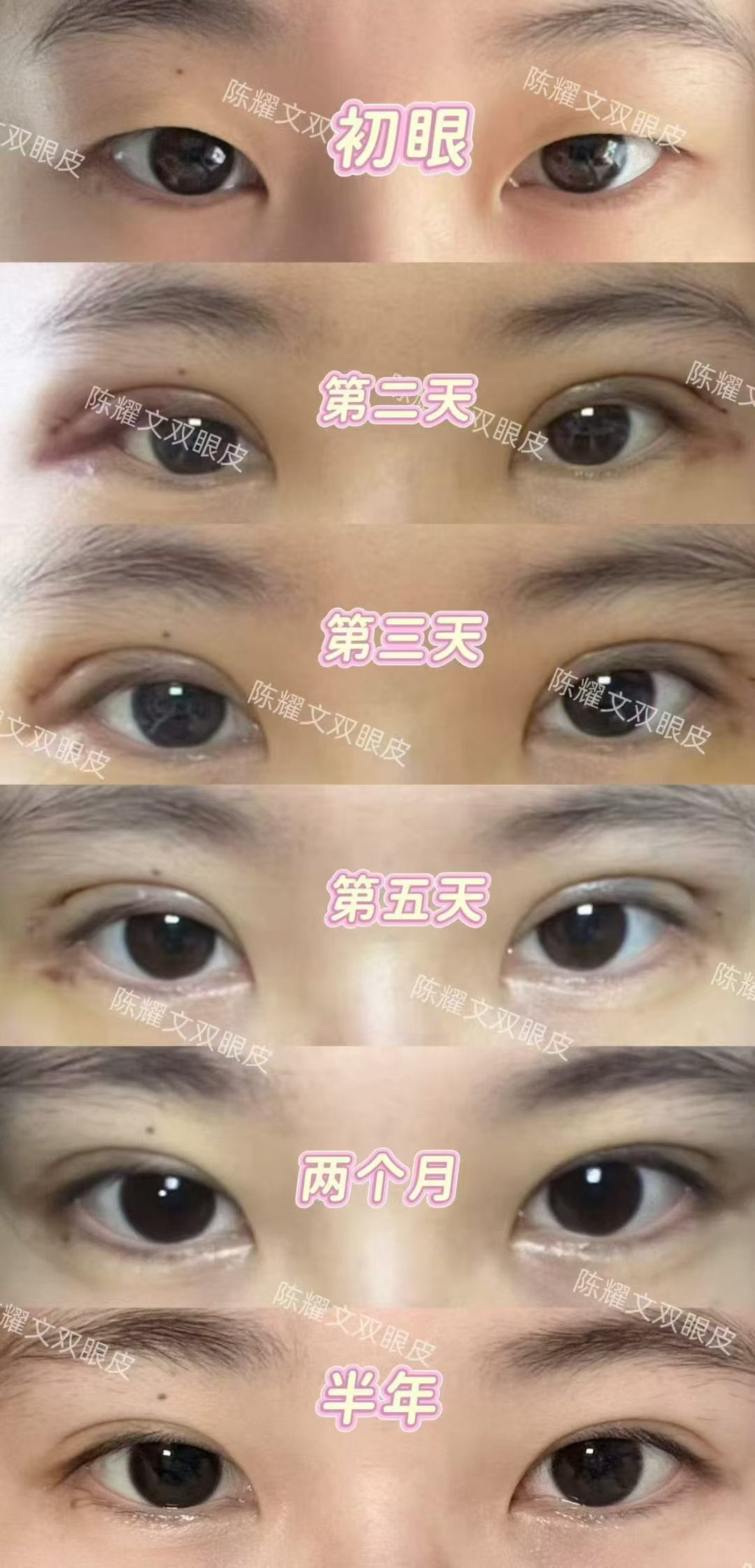 案例6